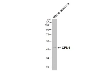 Anti-CPN1 antibody [HL3979] used in Western Blot (WB). GTX642305