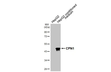 Anti-CPN1 antibody [HL3979] used in Western Blot (WB). GTX642305