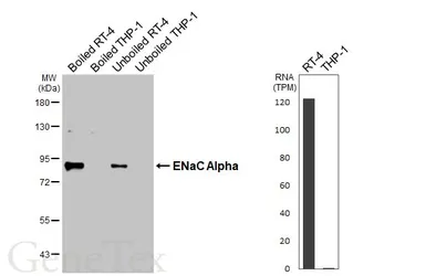 Anti-ENaC Alpha antibody [HL3980] used in Western Blot (WB). GTX642306