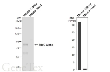 Anti-ENaC Alpha antibody [HL3980] used in Western Blot (WB). GTX642306