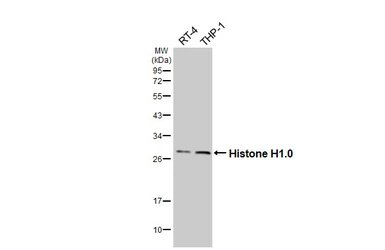 Anti-Histone H1.0 antibody [HL3982] used in Western Blot (WB). GTX642308