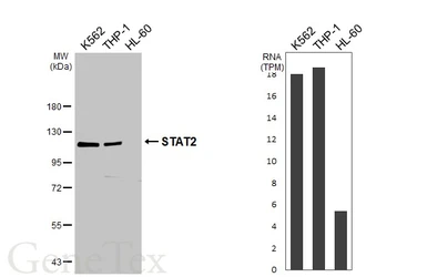 Anti-STAT2 antibody [HL3985] used in Western Blot (WB). GTX642311