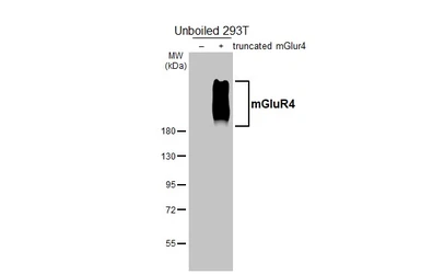 Anti-mGluR4 antibody [HL3986] used in Western Blot (WB). GTX642312