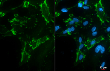 Anti-CD31 antibody [HL3991] used in Immunocytochemistry/ Immunofluorescence (ICC/IF). GTX642317