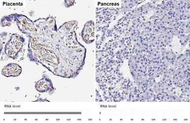 Anti-CD31 antibody [HL3991] used in IHC (Paraffin sections) (IHC-P). GTX642317