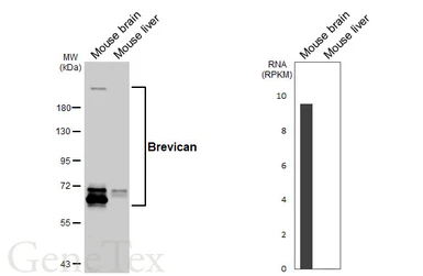 Anti-Brevican antibody [GT123] used in Western Blot (WB). GTX642324