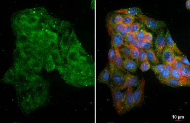 Anti-Brevican antibody [GT123] used in Immunocytochemistry/ Immunofluorescence (ICC/IF). GTX642324
