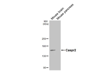 Anti-Caspr2 antibody [GT124] used in Western Blot (WB). GTX642325