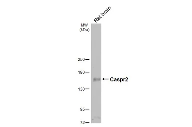 Anti-Caspr2 antibody [GT124] used in Western Blot (WB). GTX642325