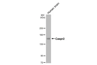 Anti-Caspr2 antibody [GT124] used in Western Blot (WB). GTX642325