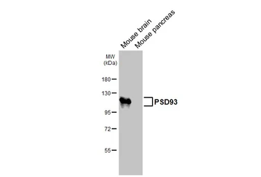 Anti-PSD93 antibody [GT126] used in Western Blot (WB). GTX642326