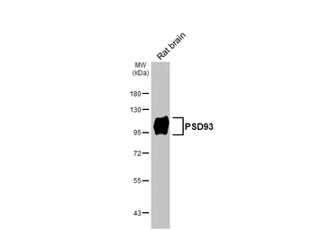 Anti-PSD93 antibody [GT126] used in Western Blot (WB). GTX642326