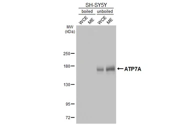 Anti-ATP7A antibody [GT128] used in Western Blot (WB). GTX642327