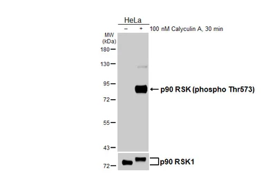 Anti-p90 RSK (phospho Thr573) antibody [HL4002] used in Western Blot (WB). GTX642333