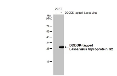 Anti-Lassa virus Glycoprotein G2 antibody [HL4006] used in Western Blot (WB). GTX642337
