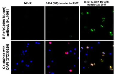 Anti-B-Raf (G469A Mutant) antibody [HL4008] used in IHC-P (cell pellet) (IHC-P (cell pellet)). GTX642339