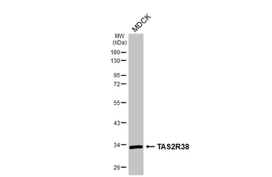 Anti-TAS2R38 antibody [HL4024] used in Western Blot (WB). GTX642355