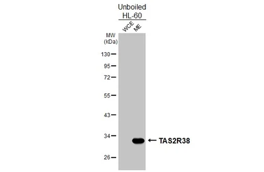 Anti-TAS2R38 antibody [HL4024] used in Western Blot (WB). GTX642355