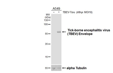 Anti-Tick-borne encephalitis virus (TBEV) Envelope antibody [HL4031] used in Western Blot (WB). GTX642362