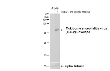 Anti-Tick-borne encephalitis virus (TBEV) Envelope antibody [HL4034] used in Western Blot (WB). GTX642365