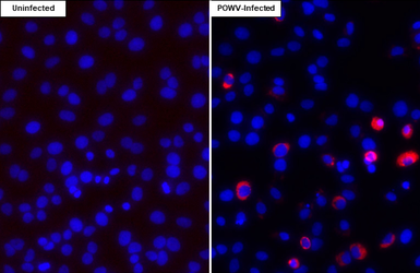 Anti-Powassan virus prM protein antibody [HL4037] used in Immunocytochemistry/ Immunofluorescence (ICC/IF). GTX642368