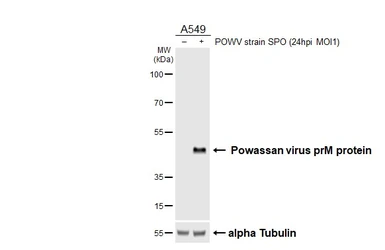 Anti-Powassan virus prM protein antibody [HL4038] used in Western Blot (WB). GTX642369