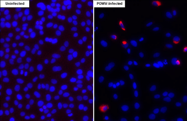 Anti-Powassan virus prM protein antibody [HL4038] used in Immunocytochemistry/ Immunofluorescence (ICC/IF). GTX642369