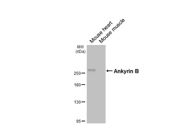 Anti-Ankyrin B antibody [GT131] used in Western Blot (WB). GTX642448