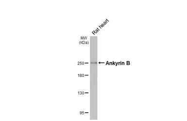 Anti-Ankyrin B antibody [GT131] used in Western Blot (WB). GTX642448
