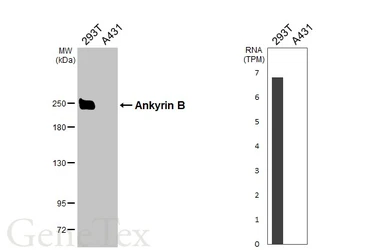 Anti-Ankyrin B antibody [GT131] used in Western Blot (WB). GTX642448