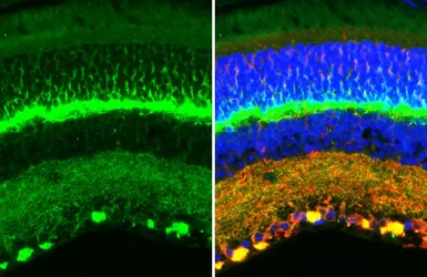 Anti-Ankyrin B antibody [GT131] used in IHC (Paraffin sections) (IHC-P). GTX642448