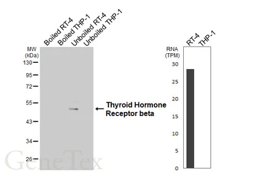 Anti-Thyroid Hormone Receptor beta antibody [GT140] used in Western Blot (WB). GTX642452