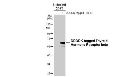 Anti-Thyroid Hormone Receptor beta antibody [GT140] used in Western Blot (WB). GTX642452