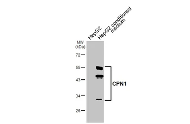 Anti-CPN1 antibody [HL4040] used in Western Blot (WB). GTX642455