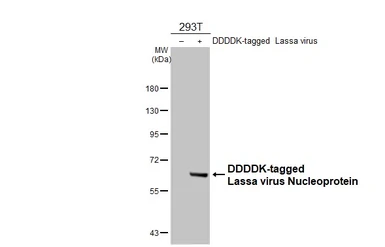 Anti-Lassa virus Nucleoprotein antibody [HL4044] used in Western Blot (WB). GTX642459