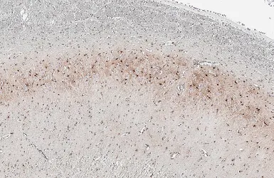 Anti-GPR54 antibody [HL4049] used in IHC (Paraffin sections) (IHC-P). GTX642464