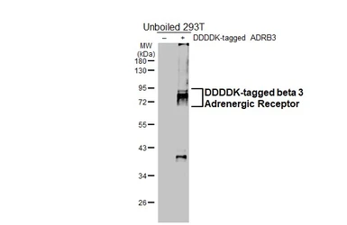 Anti-beta 3 Adrenergic Receptor antibody [HL4051] used in Western Blot (WB). GTX642466