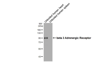Anti-beta 3 Adrenergic Receptor antibody [HL4051] used in Western Blot (WB). GTX642466