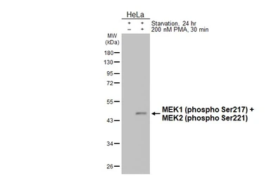 Anti-MEK1 (phospho Ser217) + MEK2 (phospho Ser221) antibody [HL4054] used in Western Blot (WB). GTX642469