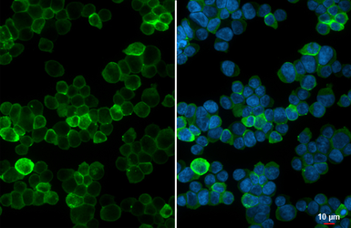 Anti-GPRC5D antibody [HL4056] used in Immunocytochemistry/ Immunofluorescence (ICC/IF). GTX642471