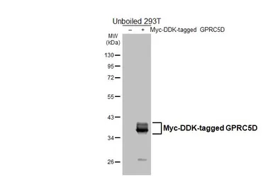 Anti-GPRC5D antibody [HL4056] used in Western Blot (WB). GTX642471