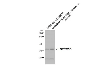 Anti-GPRC5D antibody [HL4056] used in Western Blot (WB). GTX642471