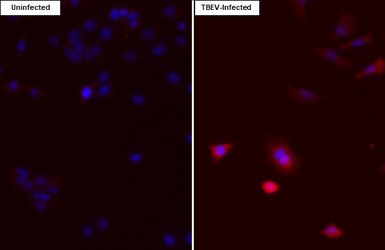 Anti-Tick-borne encephalitis virus (TBEV) NS5 antibody [HL4062] used in Immunocytochemistry/ Immunofluorescence (ICC/IF). GTX642477