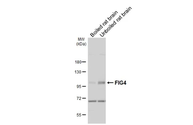 Anti-FIG4 antibody [GT149] used in Western Blot (WB). GTX642486