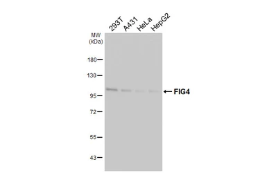 Anti-FIG4 antibody [GT149] used in Western Blot (WB). GTX642486