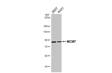 Anti-MCM7 antibody [HL4072] used in Western Blot (WB). GTX642511