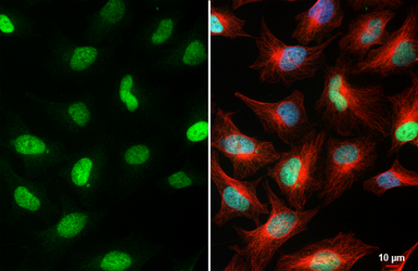 Anti-MCM7 antibody [HL4072] used in Immunocytochemistry/ Immunofluorescence (ICC/IF). GTX642511