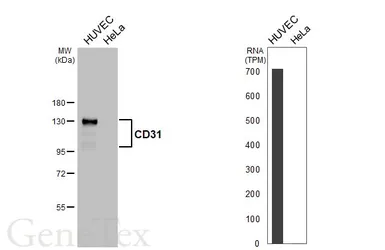 Anti-CD31 antibody [HL4073] used in Western Blot (WB). GTX642512