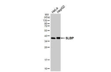 Anti-SLBP antibody [HL4075] used in Western Blot (WB). GTX642514
