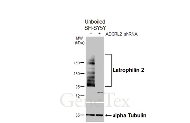 Anti-Latrophilin 2 antibody [HL4090] used in Western Blot (WB). GTX642529